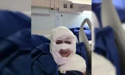 Kadıköy'de Bir Kadın, Üzerine Yanıcı Madde Dökülerek Ateşe Verildi!