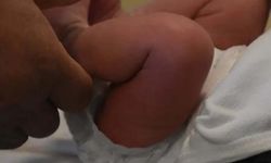 27 Günlük Bebek Sünnet Sonrası Hayatını Kaybetti!