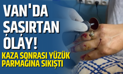 Kaza Sonrası Parmağı Şişti! Yüzüğü Keserek Çıkardılar