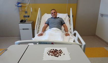 45 Yaşındaki Adamın Böbreğinden 100 Taş Temizlendi! Doktorlar Bile Şaşırdı