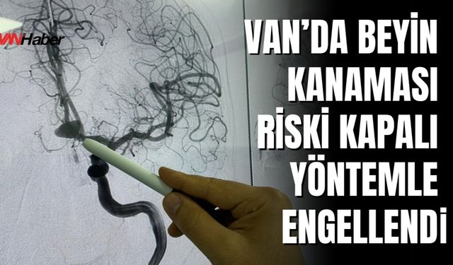 Van'da Beyin Anevrizması Ameliyatsız Yöntemle Tedavi Edildi