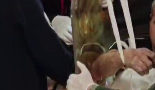 Göğüs boşluğuna demir saplanan hastanın ameliyatına itfaiye girdi