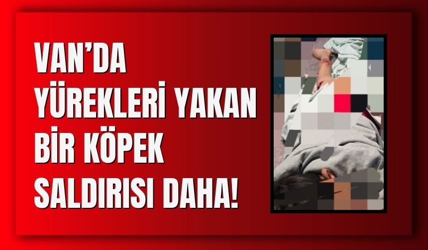 Van’da Yürekleri Yalan Bir Köpek Saldırısı Daha!