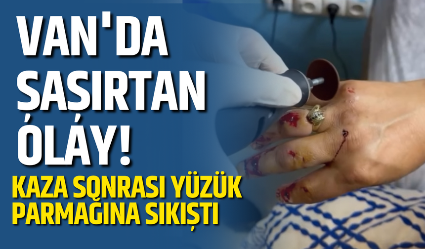Kaza Sonrası Parmağı Şişti! Yüzüğü Keserek Çıkardılar