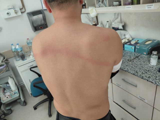 Chp3